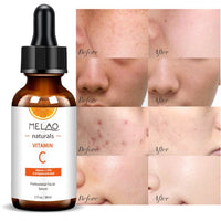 Serum naturel de vitamine C pour Visage Serum facial topique organique anti-age, 20% Vitamine C + E 30ML